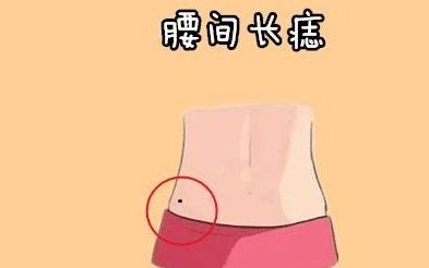 腰上长痣的女人意味什么 学科说明